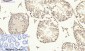 Smad3 Polyclonal Antibody